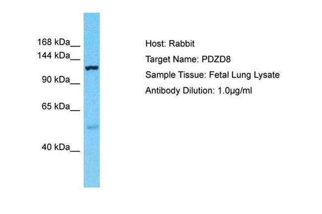 PDZD8 Antibody in Western Blot (WB)