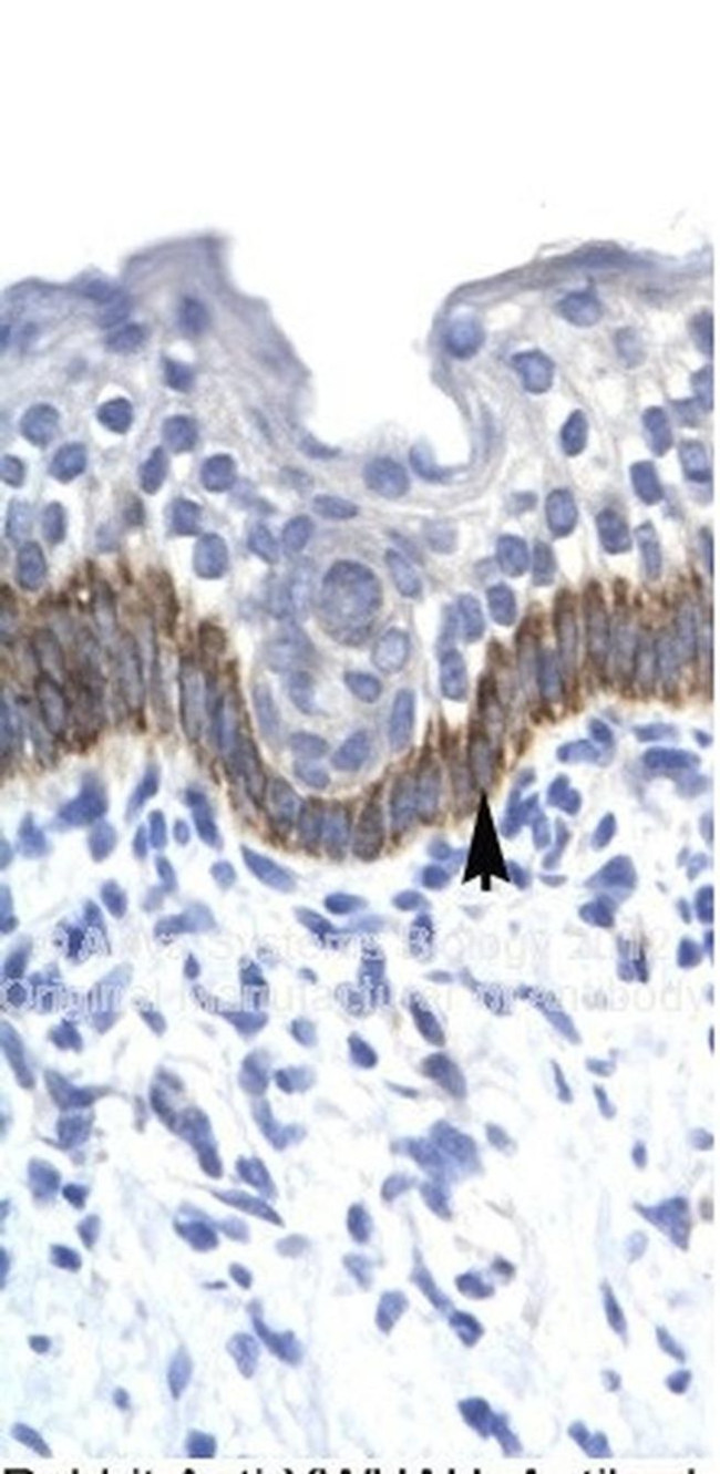 14-3-3 eta Antibody in Immunohistochemistry (IHC)