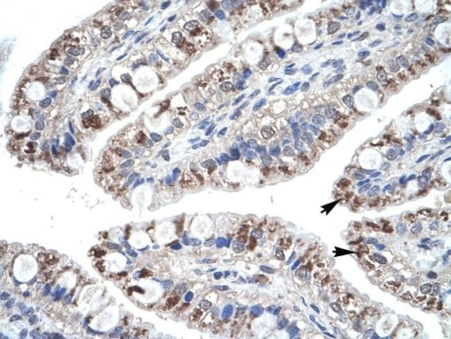 MIP-4 Antibody in Immunohistochemistry (IHC)