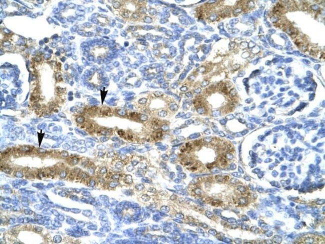 CHRND Antibody in Immunohistochemistry (IHC)