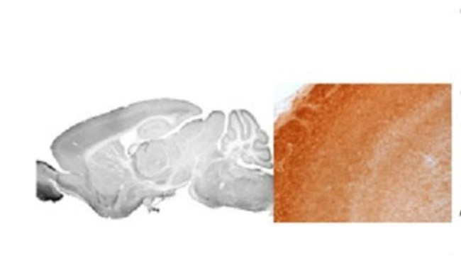 GABRA3 Antibody in Immunohistochemistry (IHC)