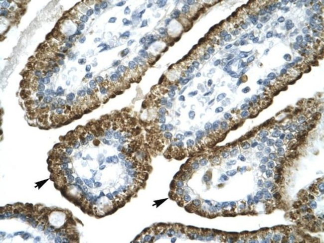 GABRP Antibody in Immunohistochemistry (Paraffin) (IHC (P))