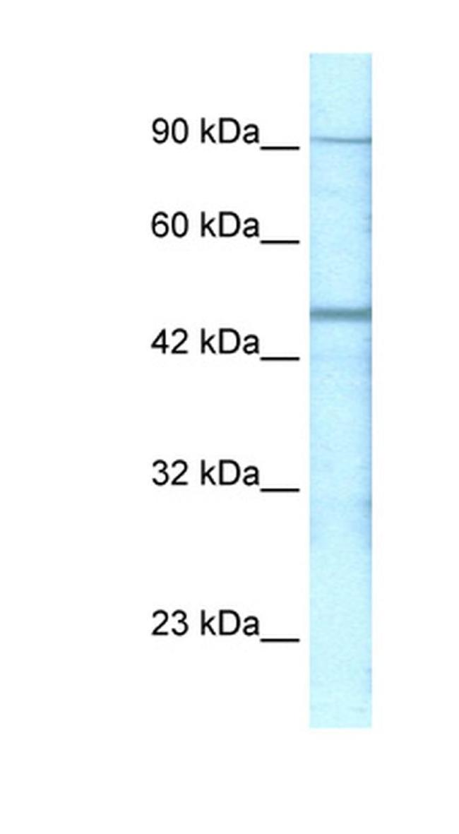 GABRP Antibody in Western Blot (WB)