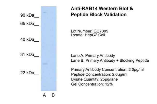 RAB14 Antibody in Western Blot (WB)