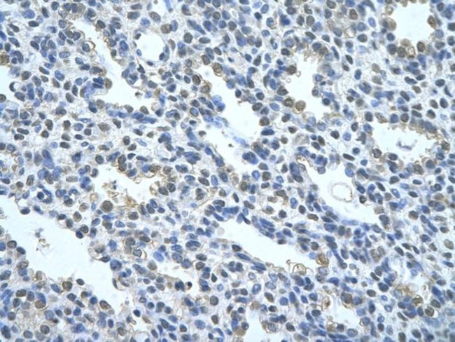 NR2F2 Antibody in Immunohistochemistry (Paraffin) (IHC (P))