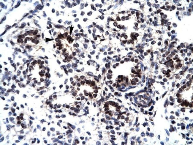 GABPB2 Antibody in Immunohistochemistry (IHC)