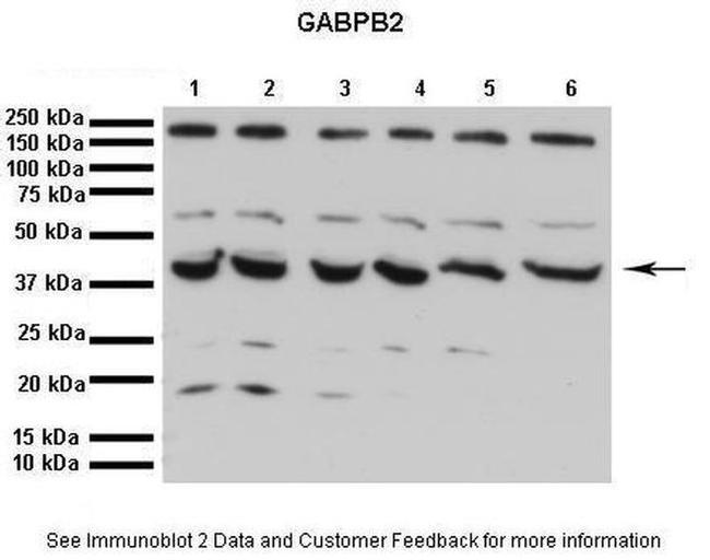 GABPB2 Antibody in Western Blot (WB)