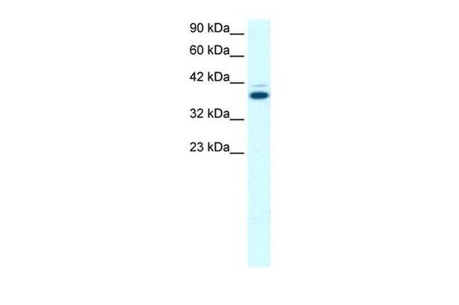 GABPB2 Antibody in Western Blot (WB)