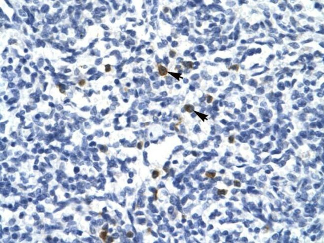 TAL1 Antibody in Immunohistochemistry (IHC)