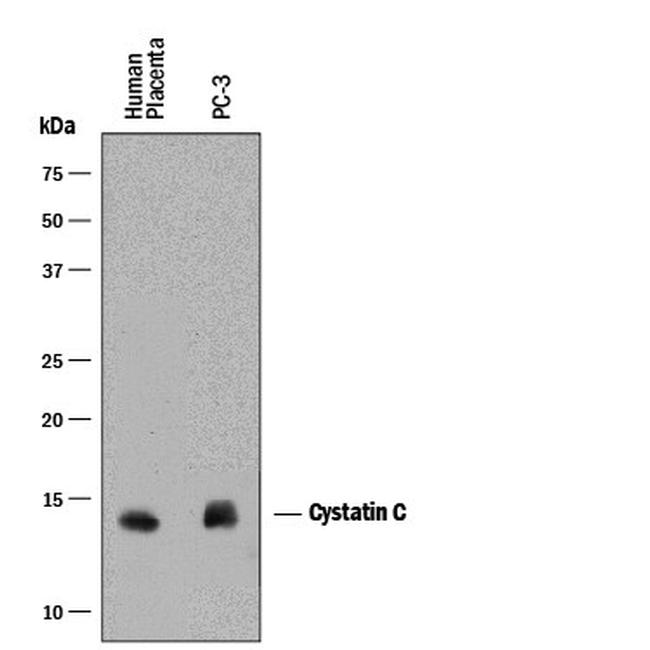 Cystatin C Antibody in Western Blot (WB)