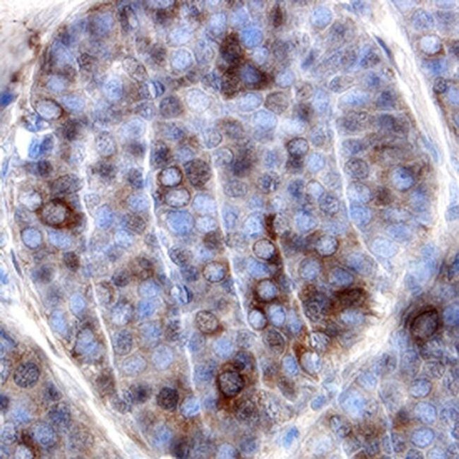 IL17D Antibody in Immunohistochemistry (Paraffin) (IHC (P))