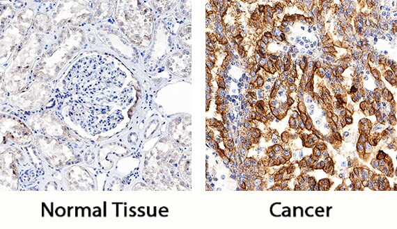 TIM-1 Antibody in Immunohistochemistry (Paraffin) (IHC (P))