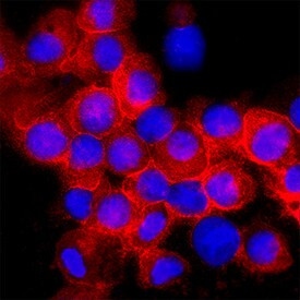 CD93 Antibody in Immunocytochemistry (ICC/IF)