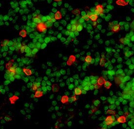 CD25 Antibody in Immunohistochemistry (Frozen) (IHC (F))