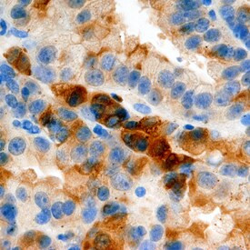 Midkine Antibody in Immunohistochemistry (Paraffin) (IHC (P))