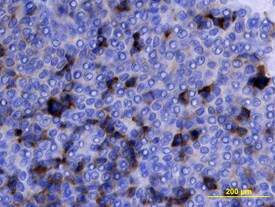 Midkine Antibody in Immunohistochemistry (Paraffin) (IHC (P))