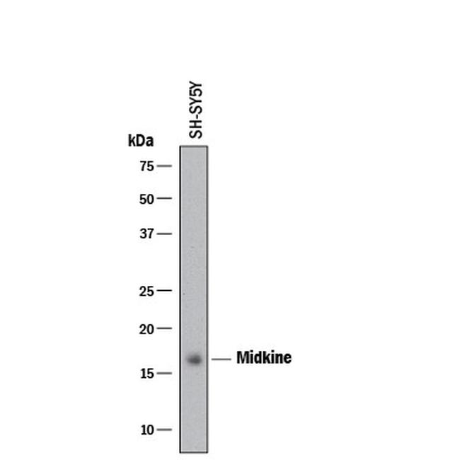 Midkine Antibody in Western Blot (WB)