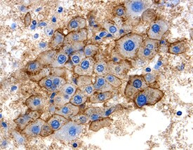 SHBG Antibody in Immunohistochemistry (Paraffin) (IHC (P))