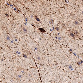 Calbindin D28K Antibody in Immunohistochemistry (Paraffin) (IHC (P))