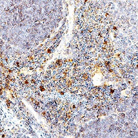 TNF alpha Antibody in Immunohistochemistry (Paraffin) (IHC (P))