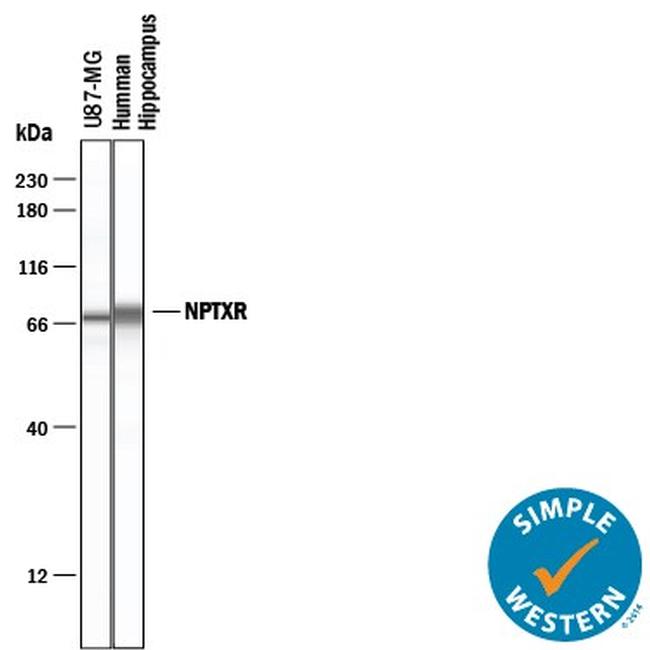 NPTXR Antibody in Western Blot (WB)