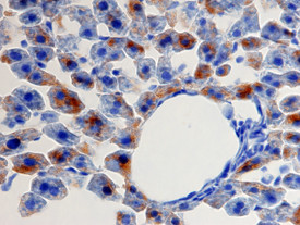 CXCL1 Antibody in Immunohistochemistry (Paraffin) (IHC (P))