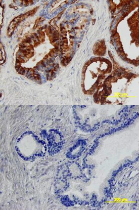 Angiopoietin 1 Antibody in Immunohistochemistry (Paraffin) (IHC (P))