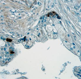 Angiopoietin 1 Antibody in Immunohistochemistry (Paraffin) (IHC (P))