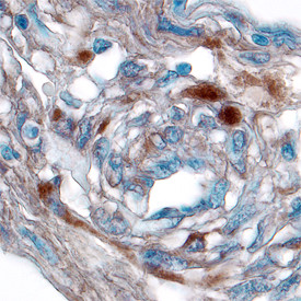 Jagged1 Antibody in Immunohistochemistry (Paraffin) (IHC (P))