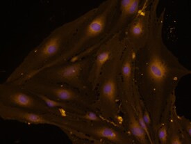 CD105 Antibody in Immunocytochemistry (ICC/IF)