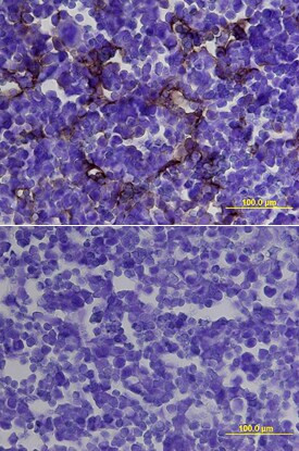 CD105 Antibody in Immunohistochemistry (Frozen) (IHC (F))