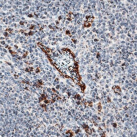 IL-17F Antibody in Immunohistochemistry (Paraffin) (IHC (P))