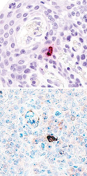 IL-17F Antibody in Immunohistochemistry (Paraffin) (IHC (P))