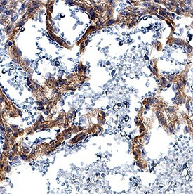 DLL4 Antibody in Immunohistochemistry (Paraffin) (IHC (P))