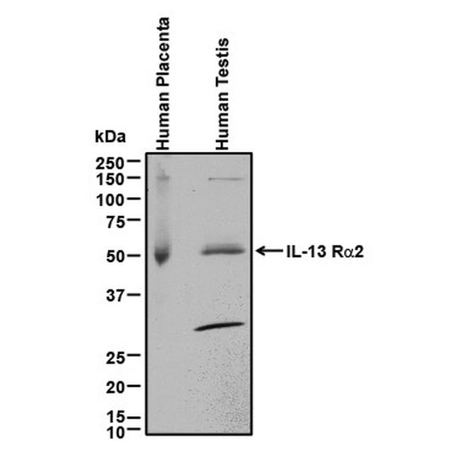 IL13RA2 Antibody in Western Blot (WB)