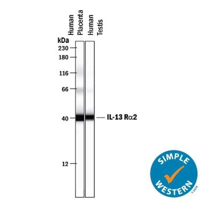 IL13RA2 Antibody in Western Blot (WB)