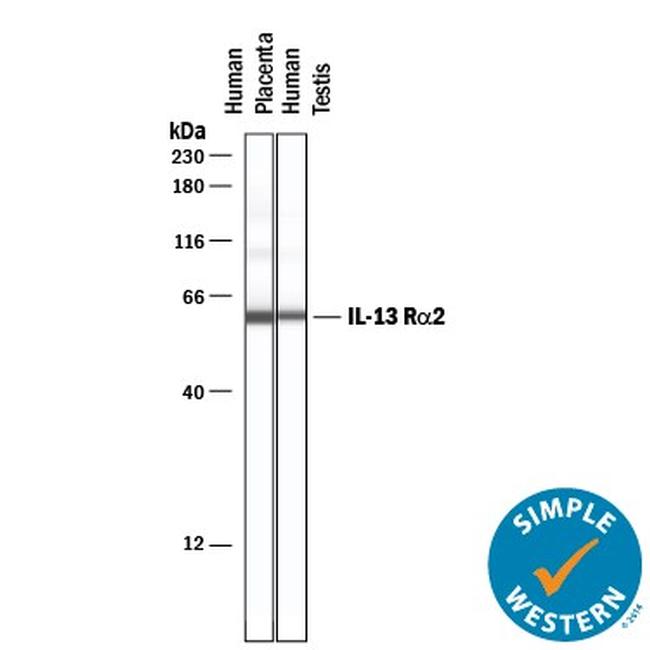 IL13RA2 Antibody in Western Blot (WB)