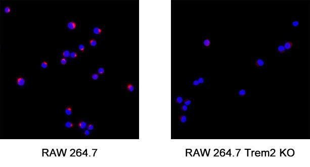 TREM2 Antibody in Immunocytochemistry (ICC/IF)