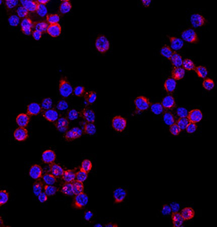 TREM2 Antibody in Immunocytochemistry (ICC/IF)