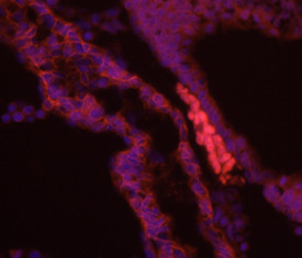 Brachyury Antibody in Immunohistochemistry (Frozen) (IHC (F))