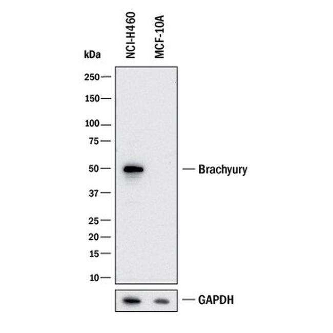 Brachyury Antibody in Western Blot (WB)