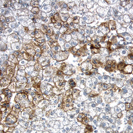 LDLR Antibody in Immunohistochemistry (Paraffin) (IHC (P))