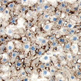 LDLR Antibody in Immunohistochemistry (Frozen) (IHC (F))