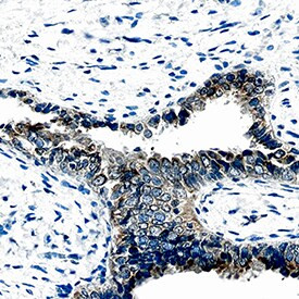 CHI3L1 Antibody in Immunohistochemistry (Paraffin) (IHC (P))