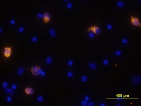 CXCL10 Antibody in Immunocytochemistry (ICC/IF)