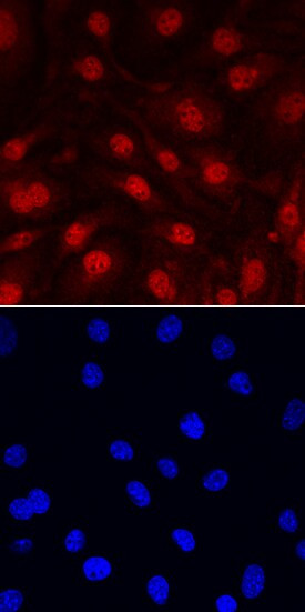 IL-33 Antibody in Immunocytochemistry (ICC/IF)