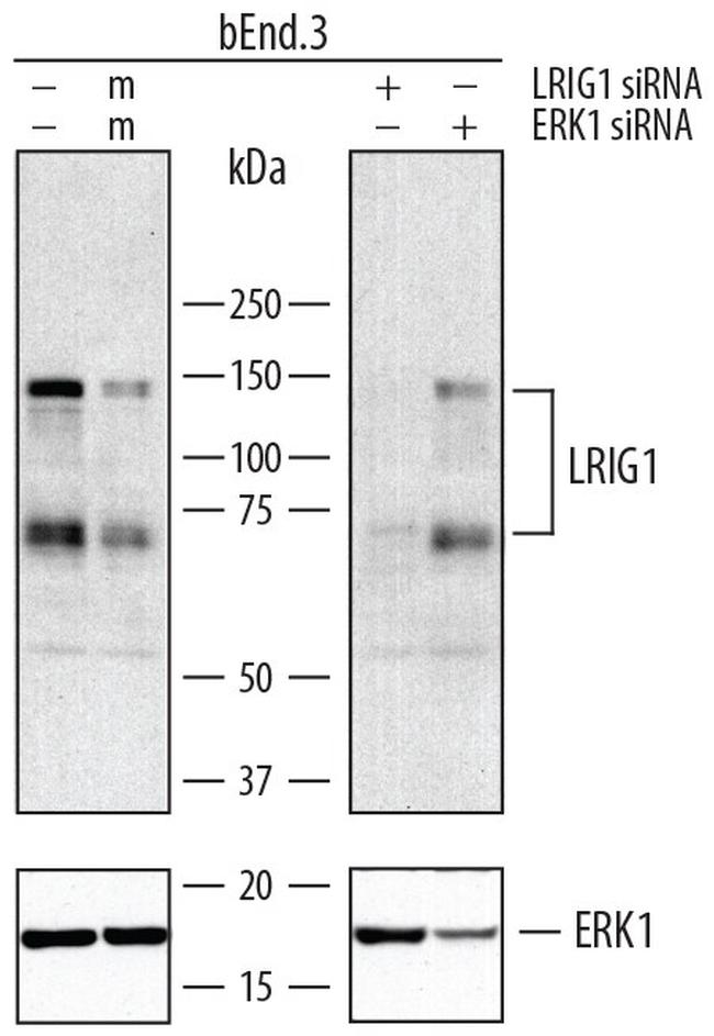 LRIG1 Antibody in Western Blot (WB)