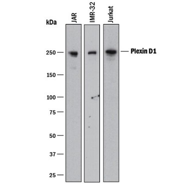 PLXND1 Antibody in Western Blot (WB)