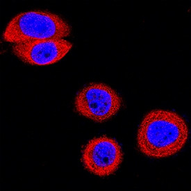 EphB2 Antibody in Immunocytochemistry (ICC/IF)