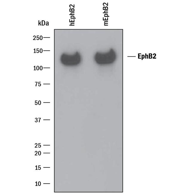 EphB2 Antibody in Western Blot (WB)